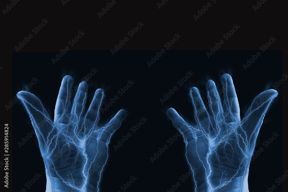 electrified hands held open in disbelief electrified hands held open in disbelief