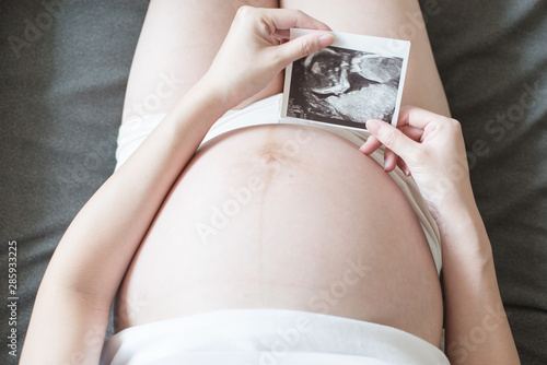 Pregnant women holding a sonogram