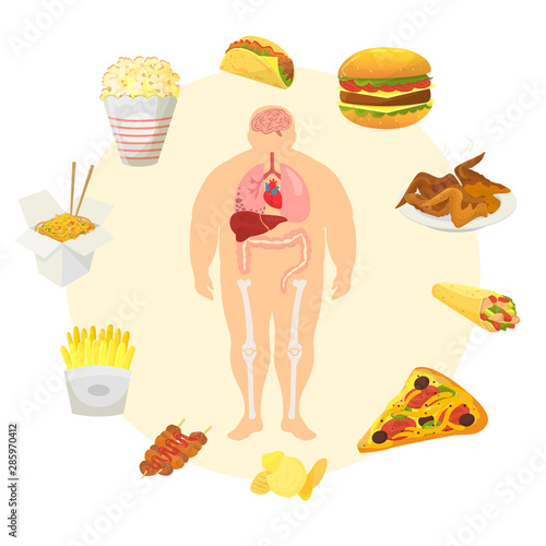 Obesity problem with fat mans body with and fast food infographic icons vector illustration. Excess weight problem, fat, health care, unhealthy lifestyle. Fast food leading tp obesity.