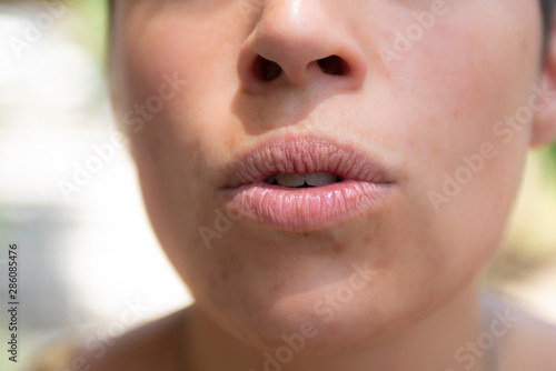 Close up of the mouth of a young woman 