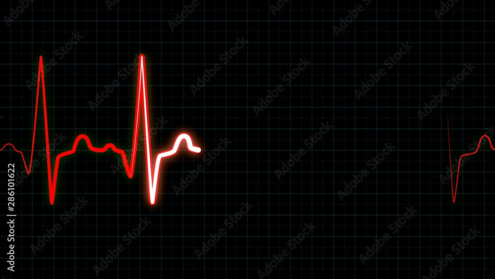 Heartbeat monitor EKG line, seamlessly loop animation, white line graph ...