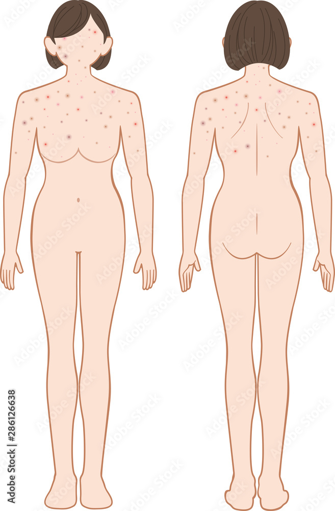 Fototapeta premium できもの 全身 女性