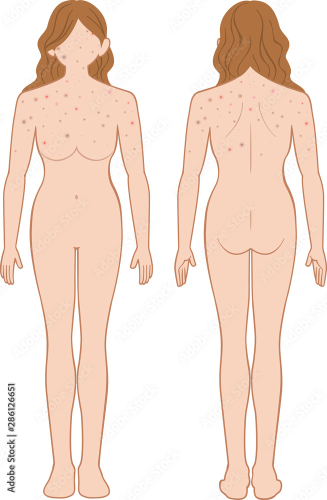 Fototapeta premium できもの 全身 女性