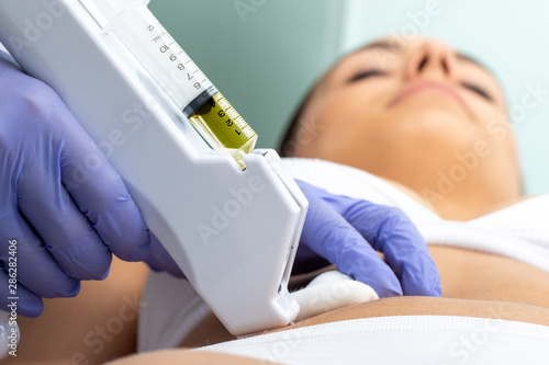 Therapist doing carboxytherapy on female belly.