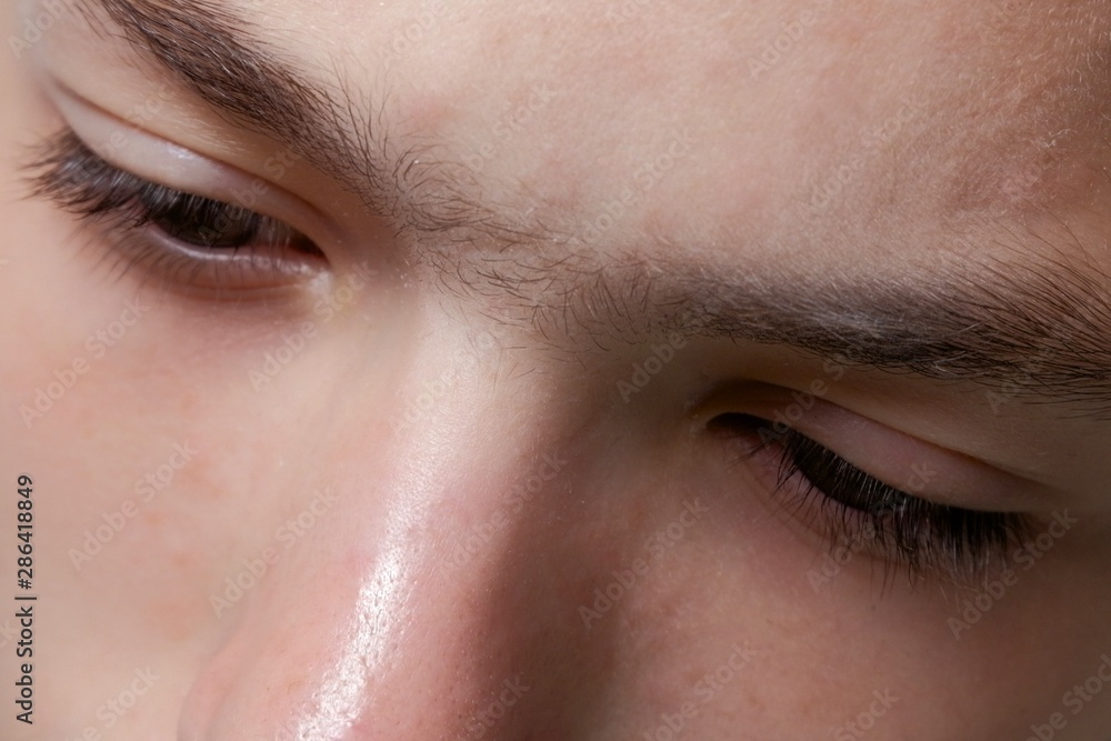Fototapeta premium Fused eyebrow between the eyes on the nose. Close-up of part of the face of a teenager guy.Preparation for the procedure for removing facial hair in a beauty salon. Sugaring. Epilation.