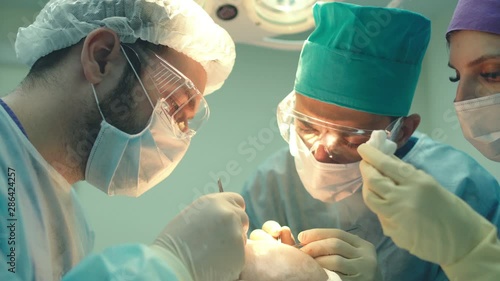 Baldness treatment. Hair transplant. Surgeons in the operating room carry out hair transplant surgery. Surgical technique that moves hair follicles from a part of the head. photo