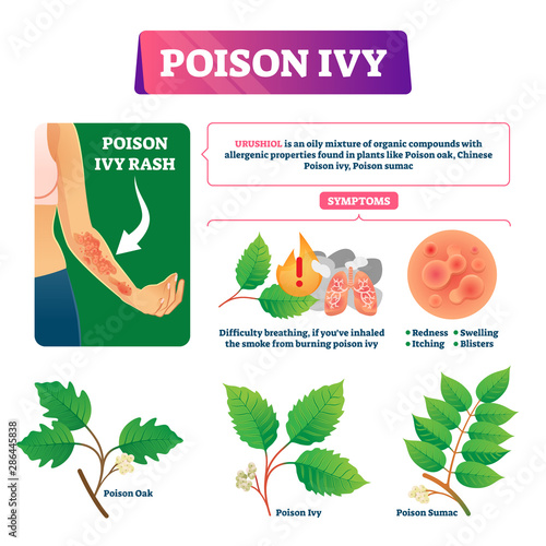 Poison ivy vector illustration. Educational dangerous urushoil plant scheme photo