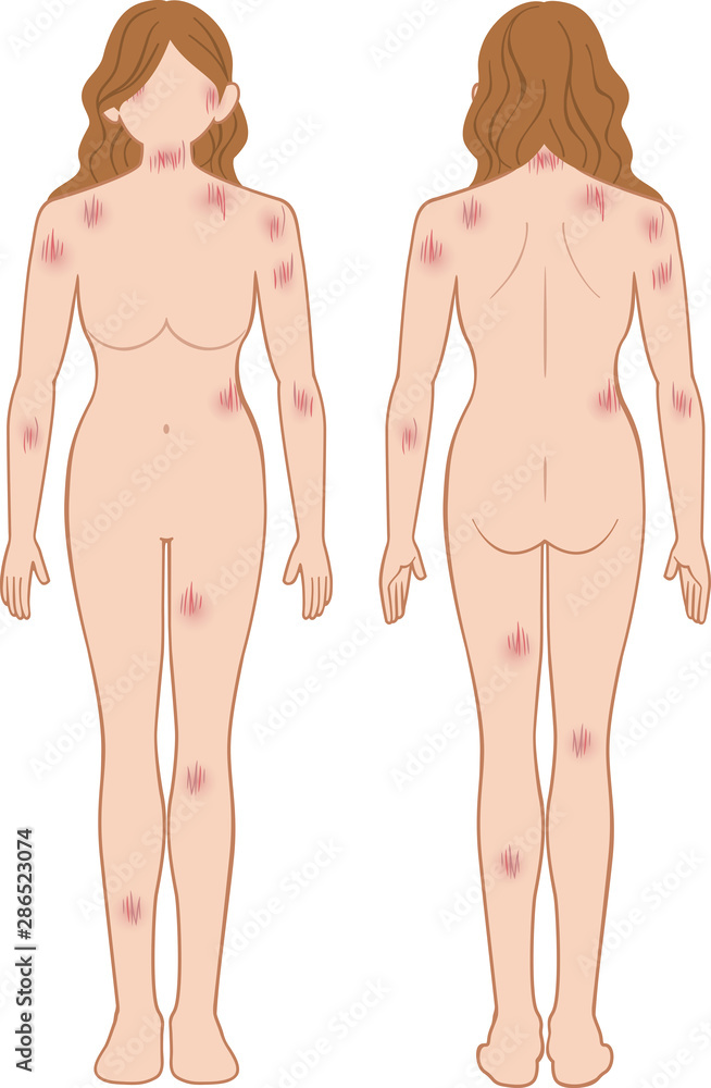 Fototapeta premium ひっかき傷 全身 女性