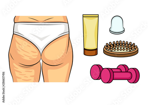 Color vector illustration before and after cellulite problems. Female hips rear view. Fat deposits on the female buttocks. Ways to combat cellulite. Infographics icons scrub, massage, fitness.