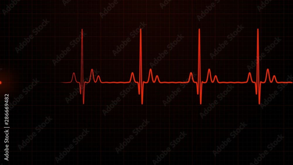 Loopable: Red EKG/ECG cardiogram oscilloscope monitor heartbeat line chart shows 60 BPM heart rate on black background with grid. Loopable: Red EKG/ECG cardiogram oscilloscope monitor heartbeat line chart shows 60 BPM heart rate on black background with grid.