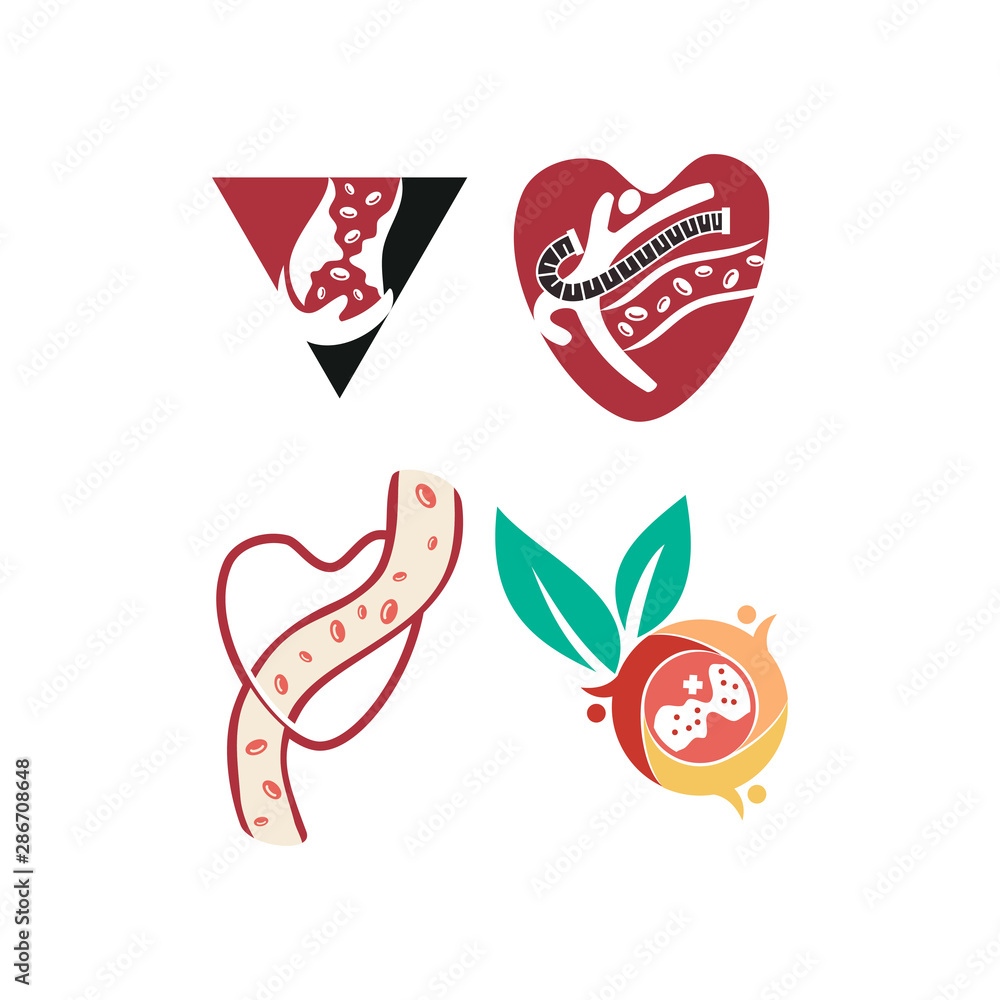 Cholesterol in artery health risk vector design Illustration Cholesterol in artery health risk vector design Illustration