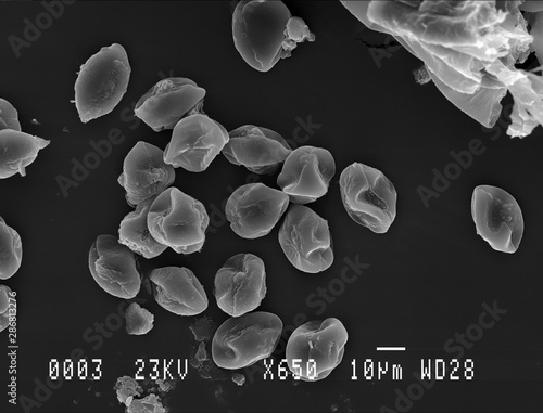 Horse chestnut pollen under electron microscope