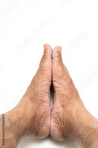 Asian man foot brown and dry skin