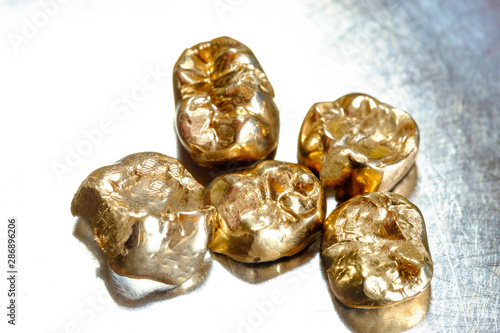 Zahngold / Goldzähne auf hellem Metall