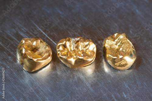 Zahngold auf Metall / Edelstahl