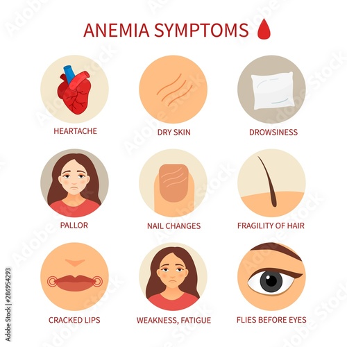 Vector medical poster anemia. Symptoms of the disease.