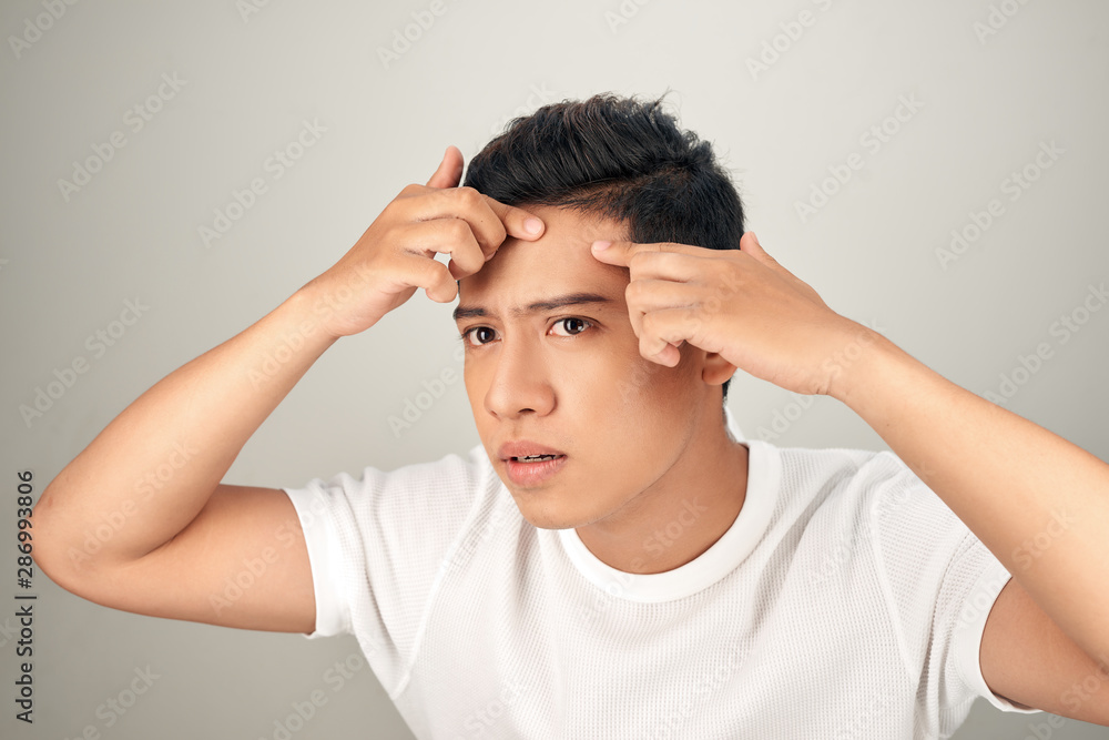 Young man struggling with acne on his face caring for his skin pushes acne Young man struggling with acne on his face caring for his skin pushes acne