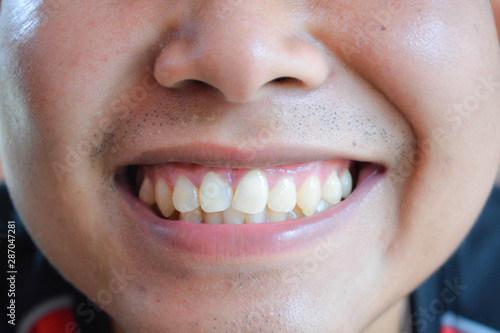 woman with white teeth
