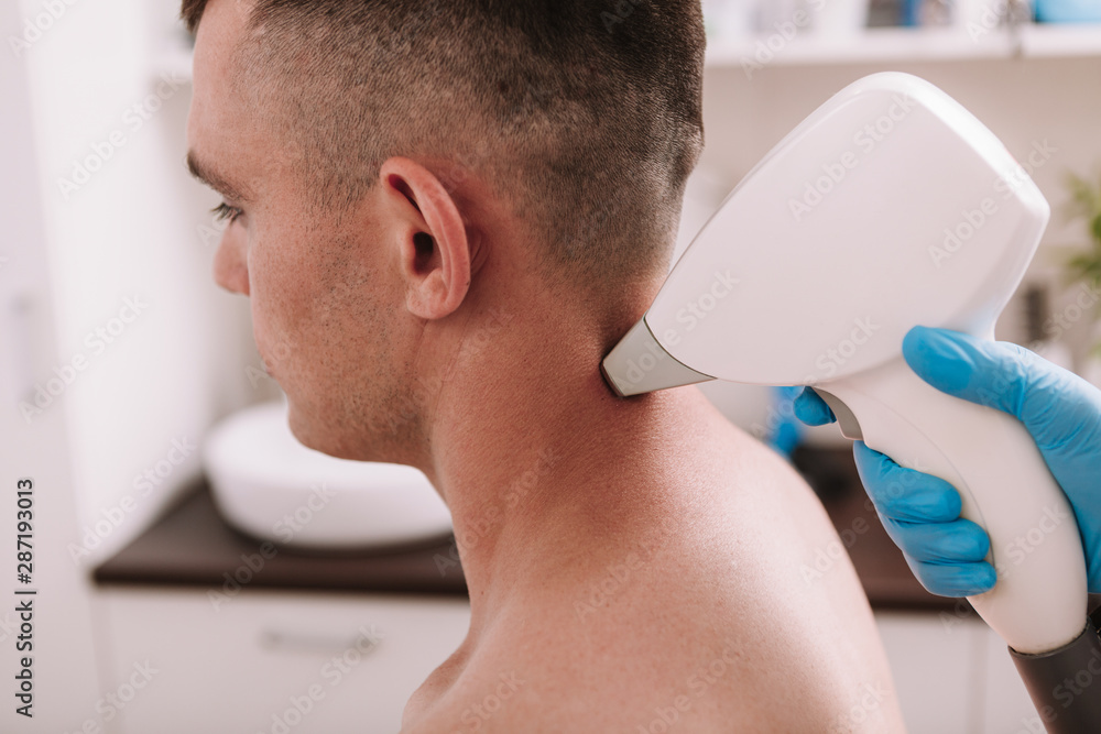 Cropped shot of a man getting laser hair removal treatment at beauty  clinic. Beautician removing excessive hair on the back of the neck of a  male client Stock Photo | Adobe Stock