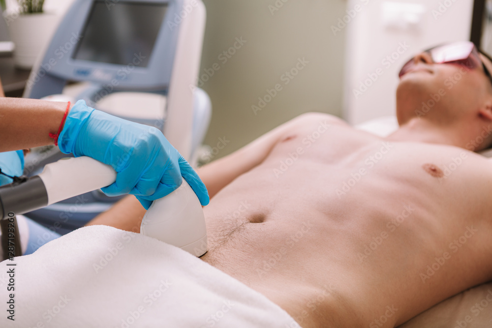 Beautician removing pubic hair of a male client with laser. Man getting laser  hair removal treatment Stock Photo | Adobe Stock