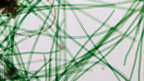 Study of Oscillatoria is a genus of filamentous cyanobacterium, oscillation in its movement under the microscope.  photo