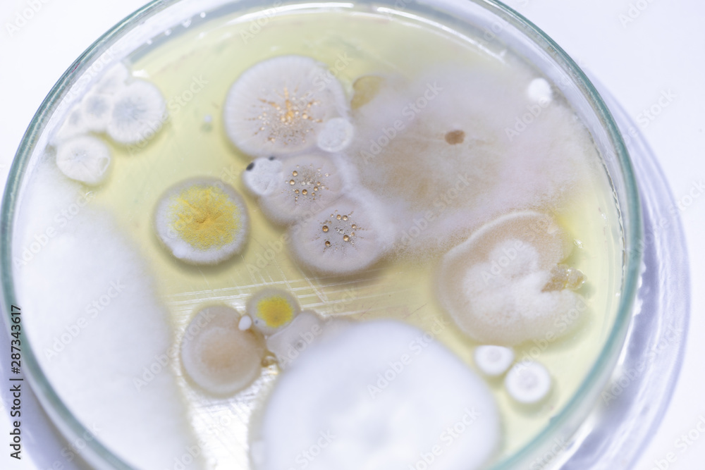 Backgrounds of Characteristics and Different shaped Colony of Bacteria and Mold growing on agar plates from Soil samples for education in Microbiology laboratory. Backgrounds of Characteristics and Different shaped Colony of Bacteria and Mold growing on agar plates from Soil samples for education in Microbiology laboratory.