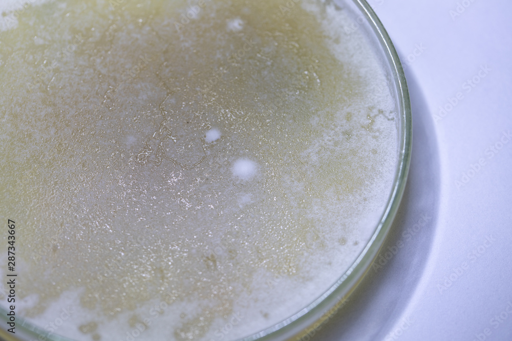 Backgrounds of Characteristics and Different shaped Colony of Bacteria and Mold growing on agar plates from Soil samples for education in Microbiology laboratory. Backgrounds of Characteristics and Different shaped Colony of Bacteria and Mold growing on agar plates from Soil samples for education in Microbiology laboratory.