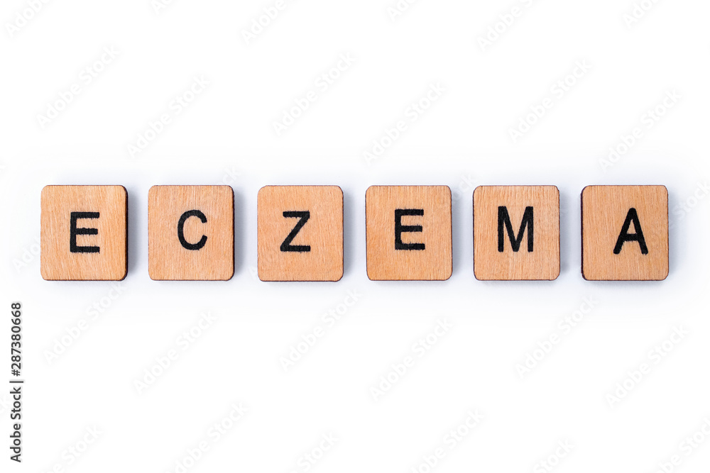 The word ECZEMA The word ECZEMA