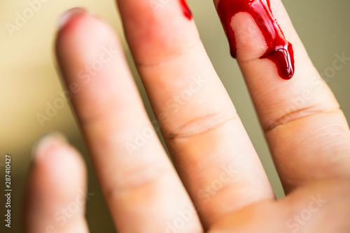Finger cut, bleeding injured with knife, Flesh blood wound in hand