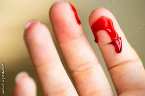Photos Finger cut, bleeding injured with knife, Flesh blood wound in hand