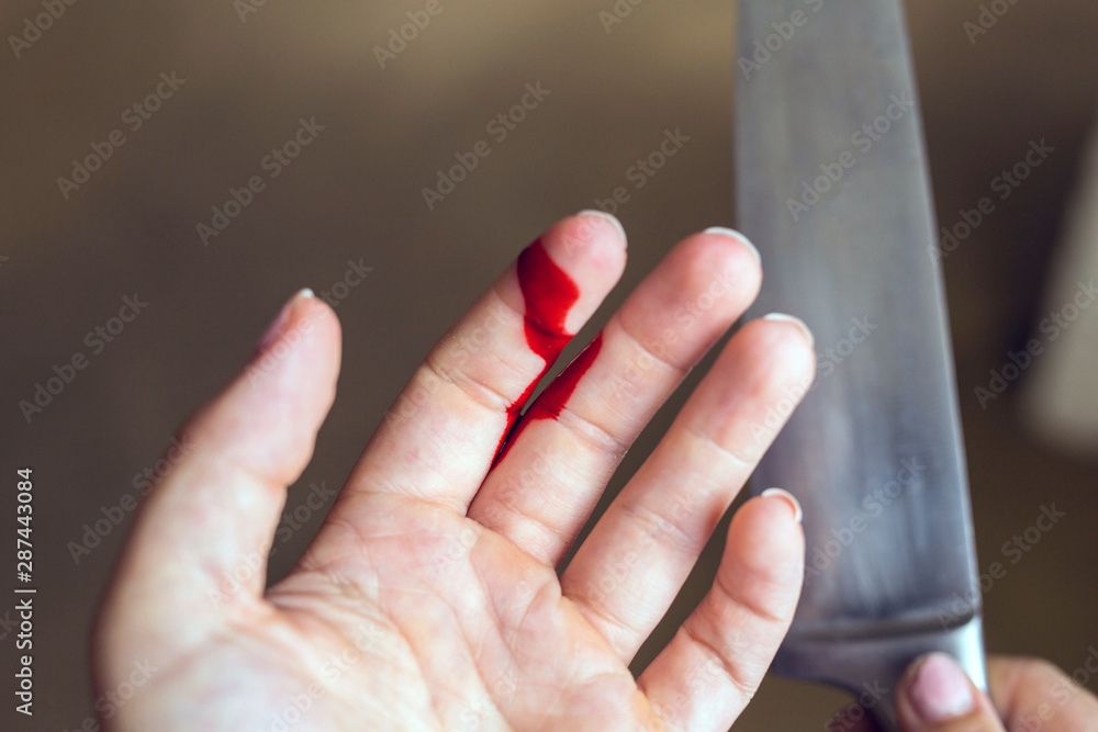 Finger cut, bleeding injured with knife, Flesh blood wound in hand