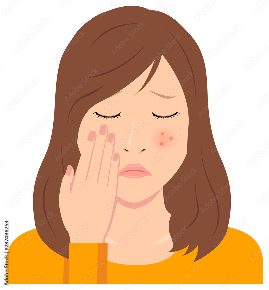 Young woman vector illustration (upper body) / acne, pimple, treckles, rash Young woman vector illustration (upper body) / acne, pimple, treckles, rash