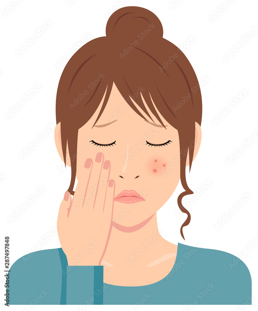 Young woman vector illustration (upper body) / acne, pimple, treckles, rash Young woman vector illustration (upper body) / acne, pimple, treckles, rash