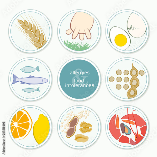 allergies and food intolerances infographics
