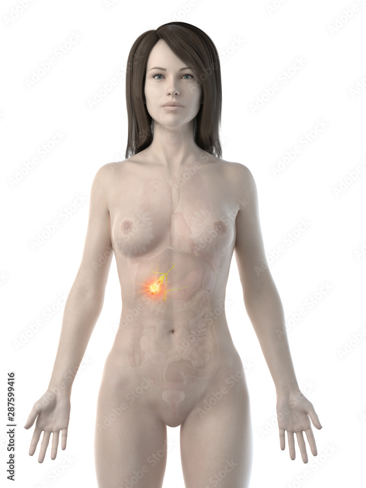 Naklejka premium 3d rendered medically accurate illustration of a womans gallbladder cancer