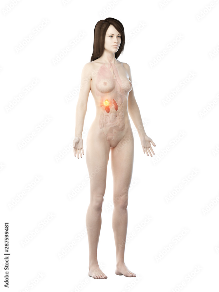 Naklejka premium 3d rendered medically accurate illustration of a womans kidneys cancer