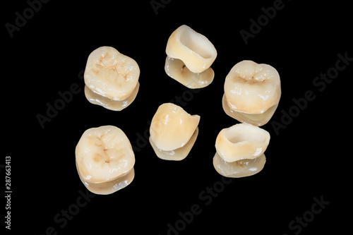 ceramic crowns of human teeth closeup macro isolate on a black background. The concept of aesthetic dentistry