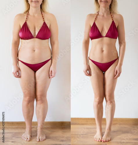 Foto Real photo of woman before and after weight loss