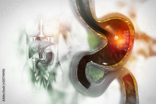 Tapety artystyczne Stomach Endoscopy on scientific background