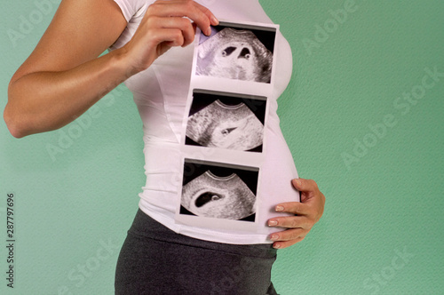 The girl is holding a snapshot of an ultrasound twin in the fourth week of pregnancy. First trimester. Confirmation of pregnancy.