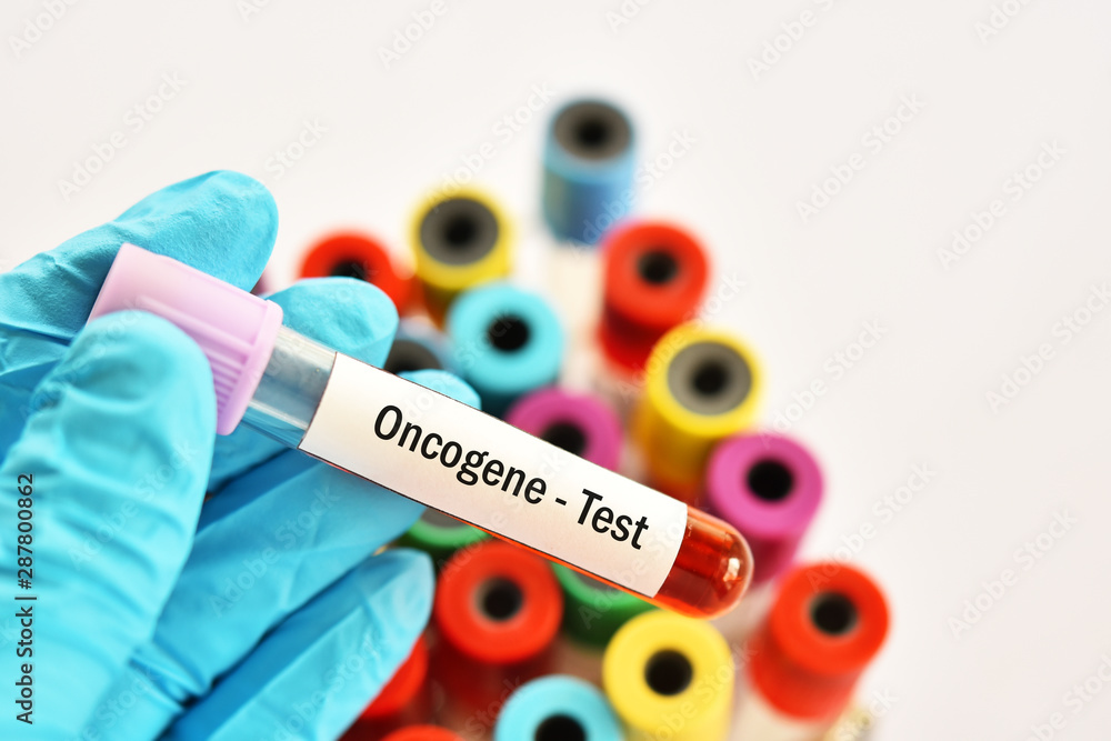 Fototapeta premium Blood sample tube for oncogene test, cancer gene detection