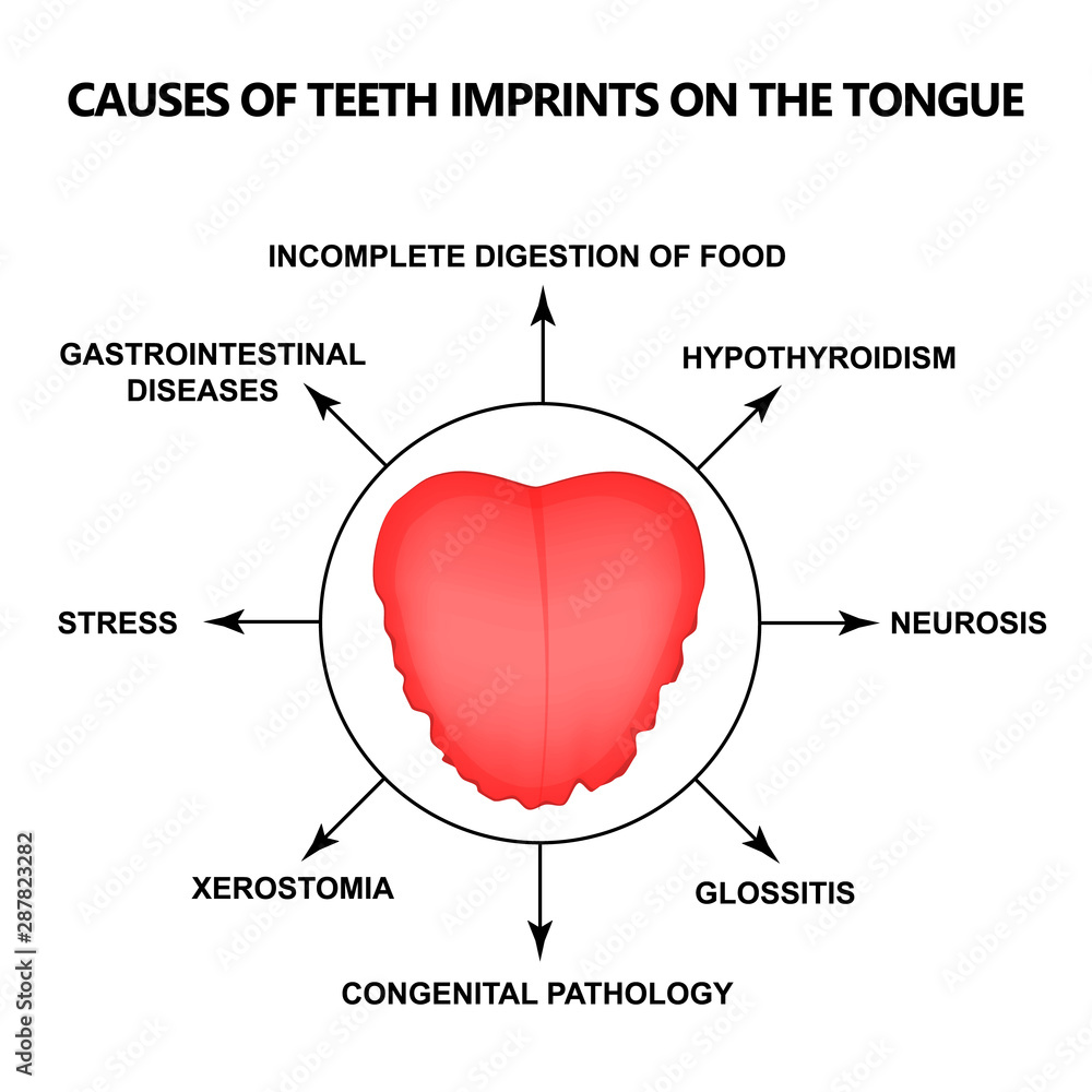 What Causes Inflammation On The Tongue