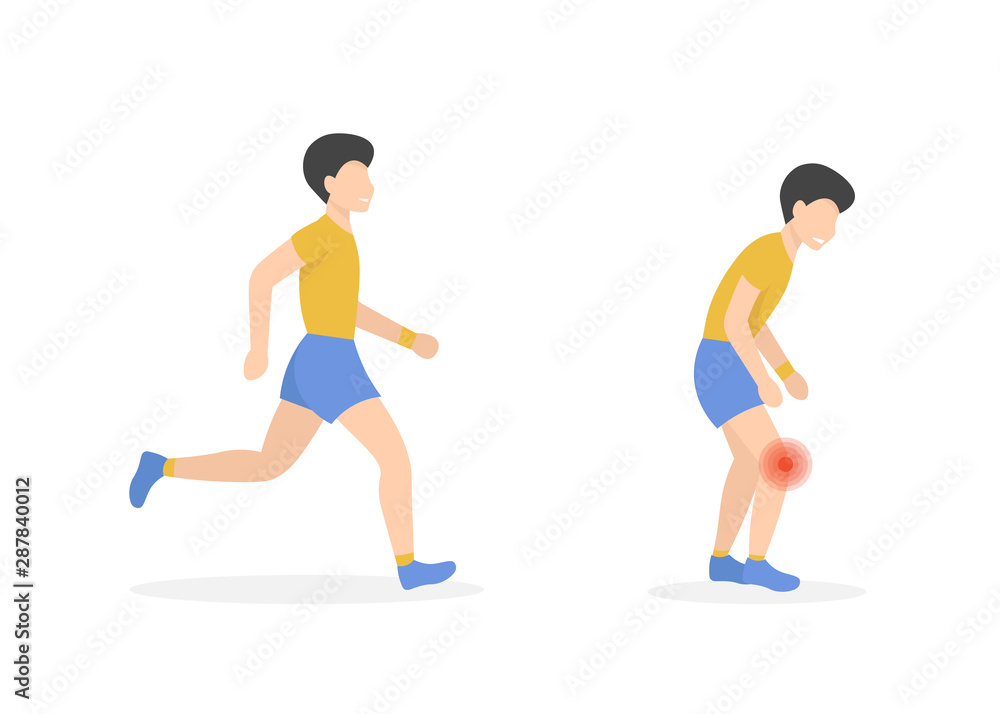 Athlete gets injured while running, sore knee. Flat vector male character isolated on white background. Athlete gets injured while running, sore knee. Flat vector male character isolated on white background.