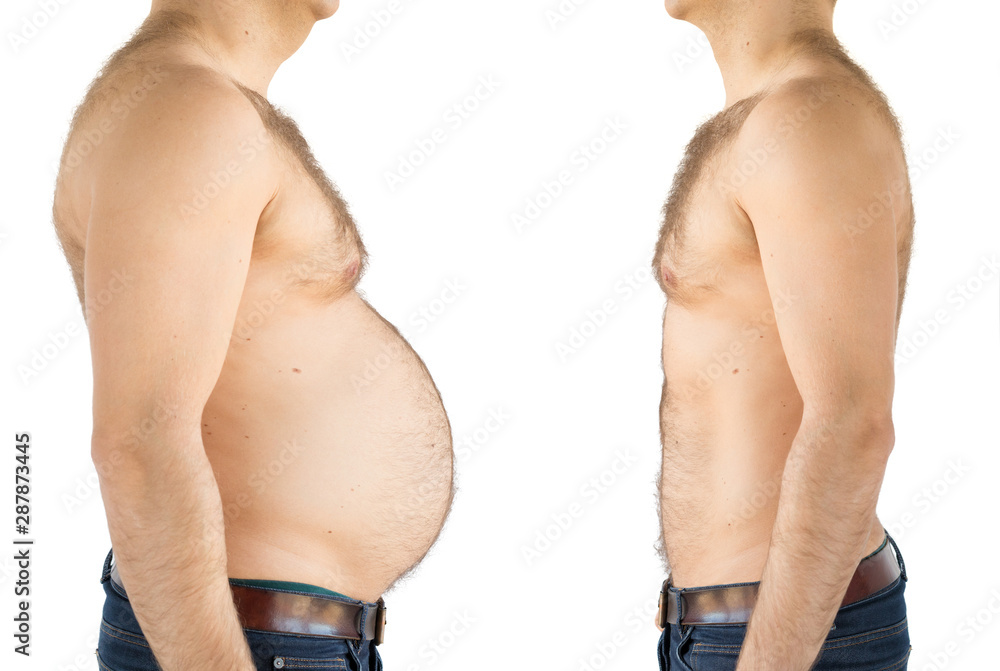 Man before and after weight loss - obrazy, fototapety, plakaty 