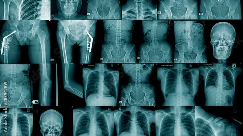 collection x-ray image with slinding up movement footage 