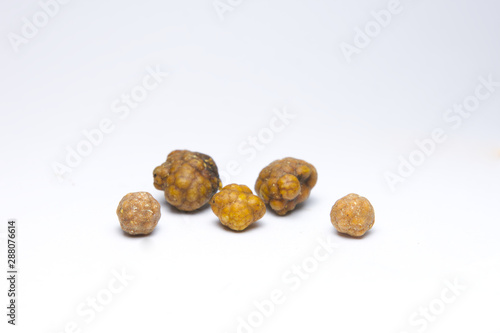 Gallstones,multiple cholesterol stone in gall bladder with cholecystitis . photo