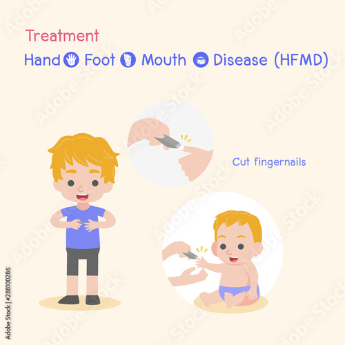 Treatment, Children infected, Baby and child have a Hand Foot Mouth  Disease, Medical Health care concept, Cut fingernails, nails, cartoon  character vector design. Stock Vector | Adobe Stock