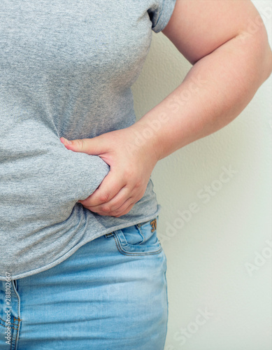 Obesity. Obese Woman Holding His Belly Fat With Both Hands Giving An Expression Of Shock.
