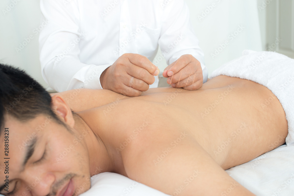 The doctor uses the needle into the body The back of a young man on acupuncture, Chinese acupuncture and alternative medicine The doctor uses the needle into the body The back of a young man on acupuncture, Chinese acupuncture and alternative medicine
