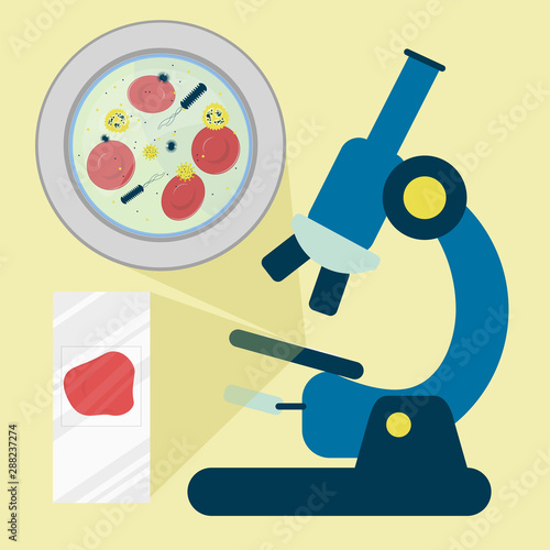 Blood sample under a microscope showing red blood cells with germs (cells and flagellated bacteria). Microscope slide with blood sample.